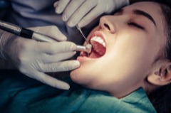 Mersin Dolgu Diş En İyi Dİş Doktoru