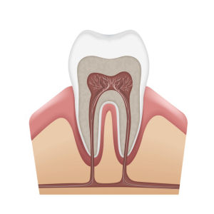 Mersin Endodonti Kanal Tedavisi Diş Hekimi